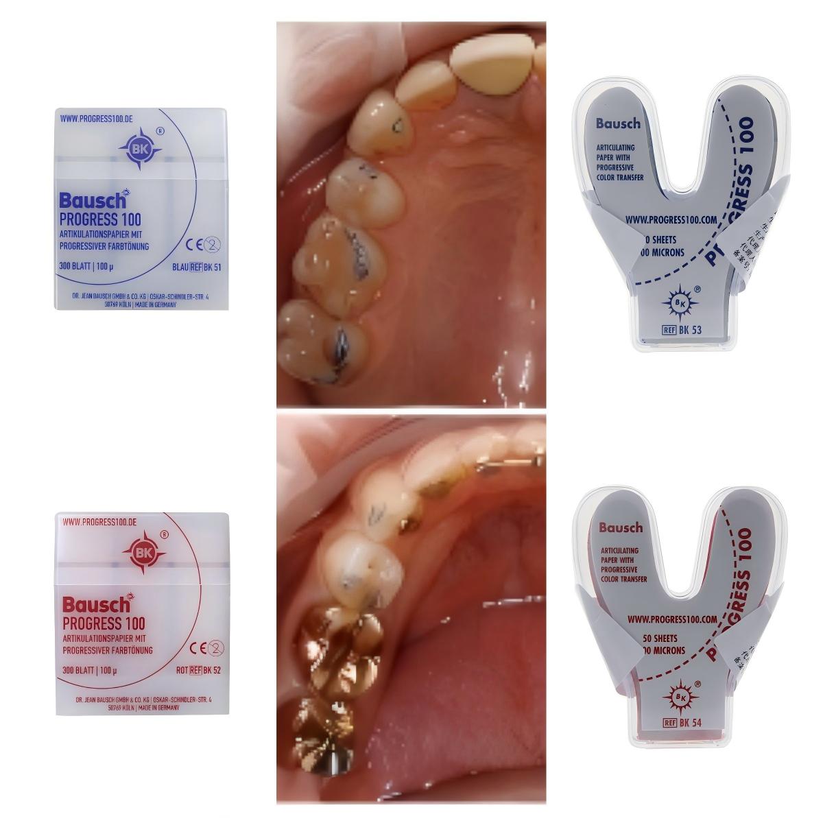 Carta Articolatrice Dentale Ba - Bite Indicator recensione e prezzo
